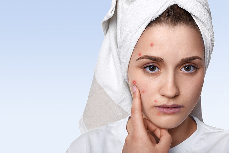 Pigmentation Treatment