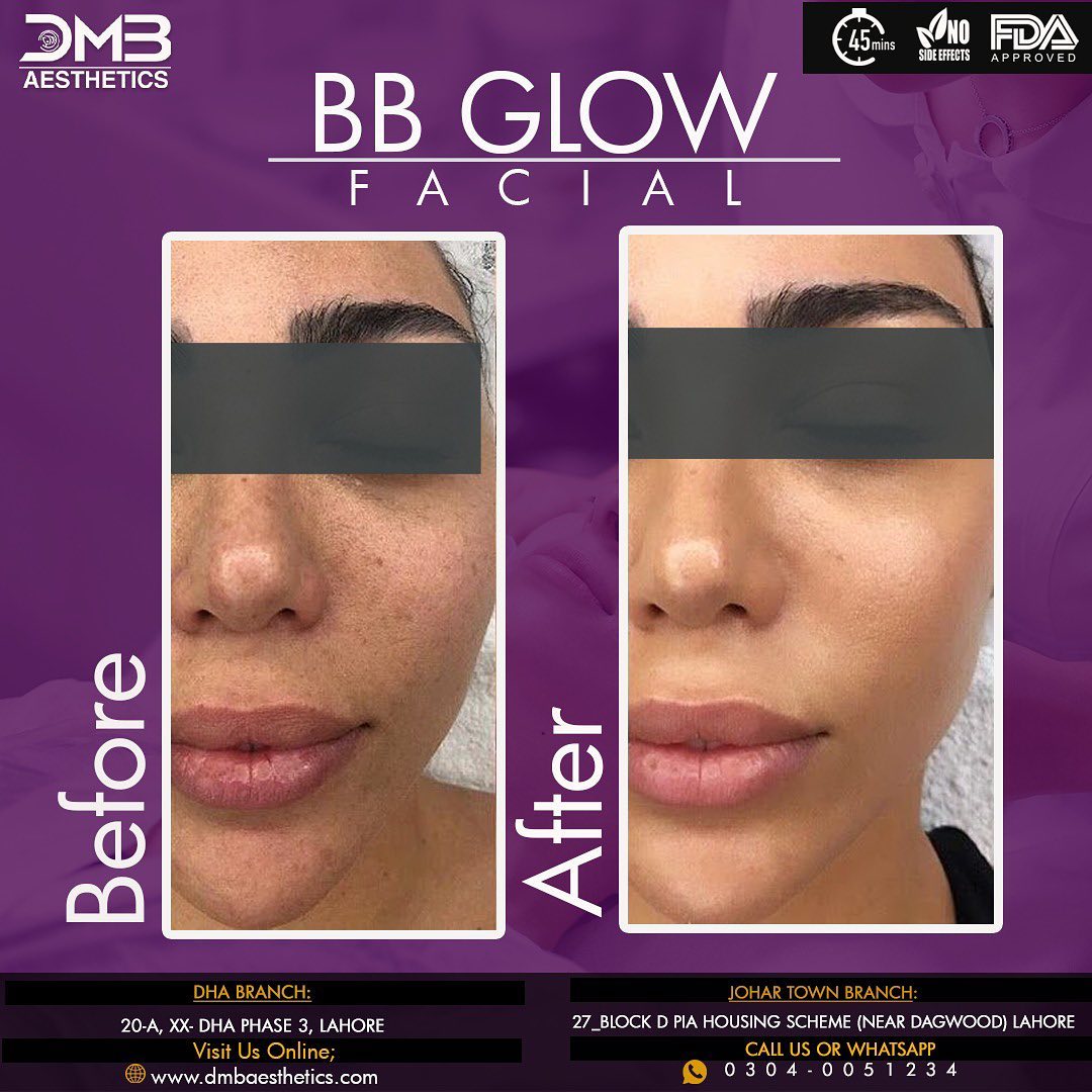 BBGlow_02.jpg