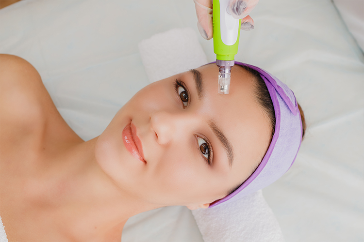 Microneedling (Collagen Induction Therapy)
