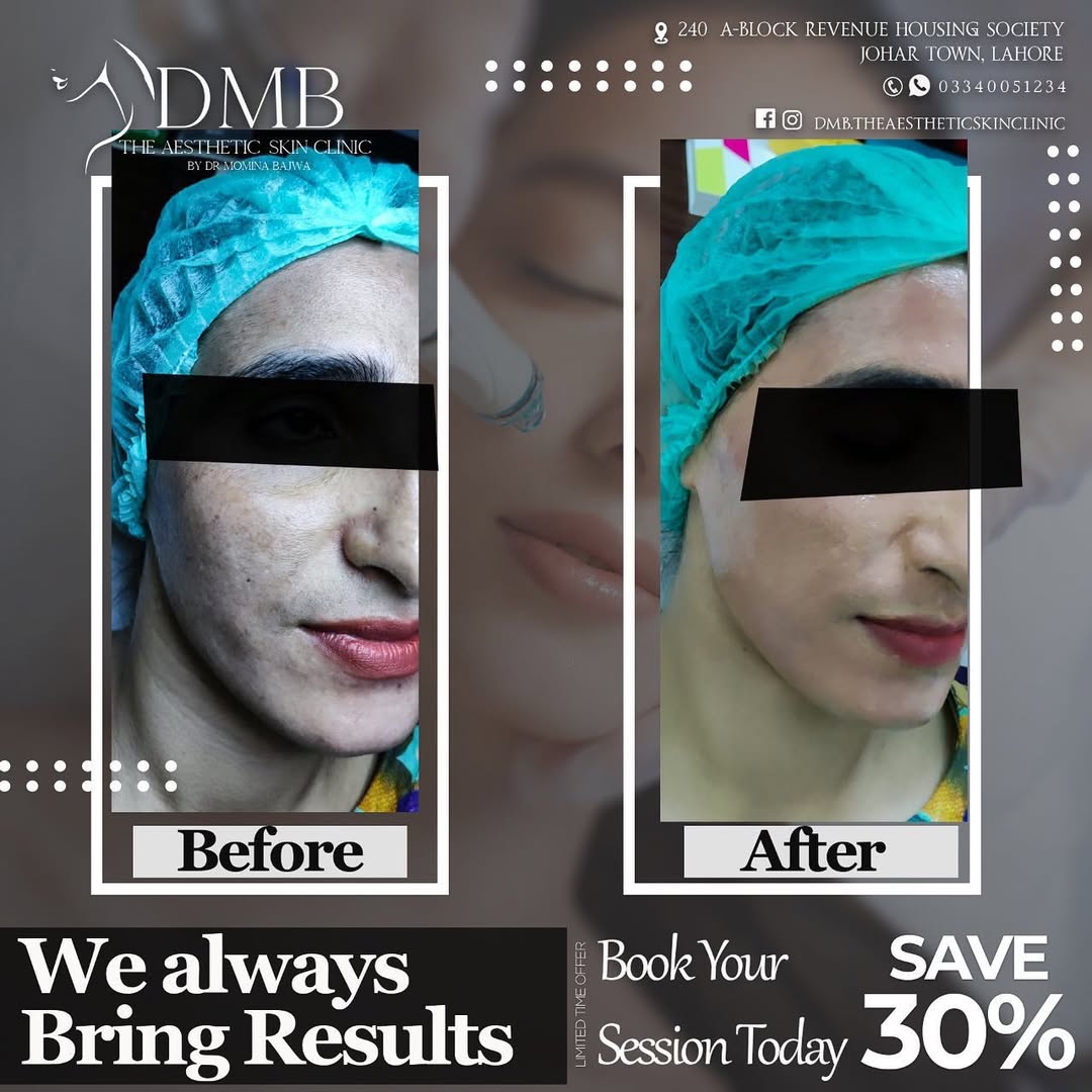 BBGlow_12.jpg