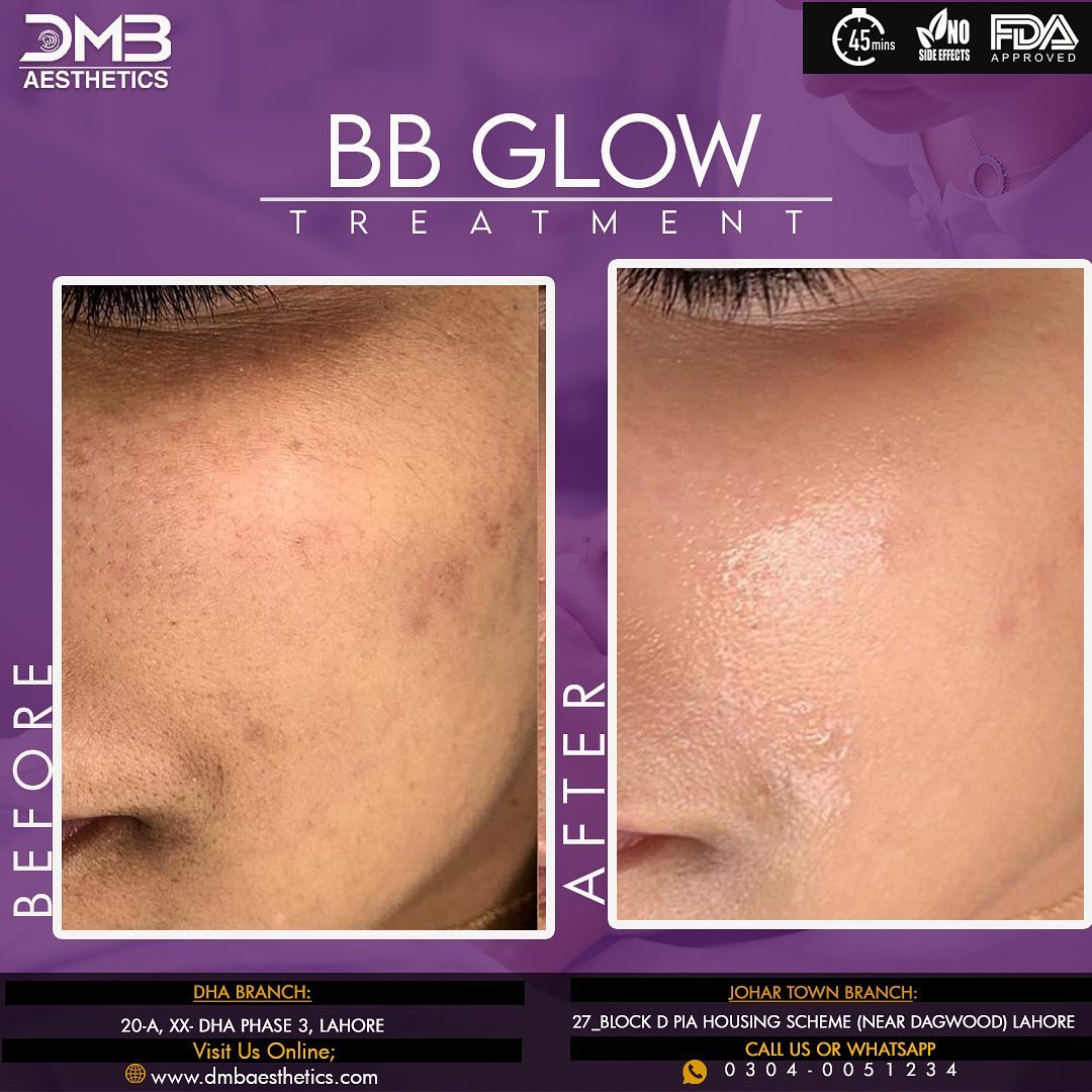 BBGlow_09.jpg